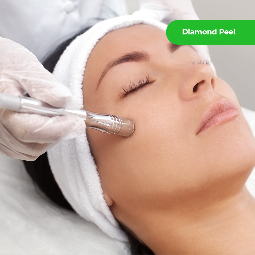 Diamond Peel